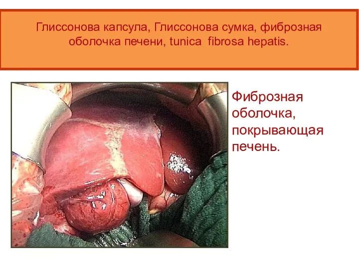 Глиссонова капсула, Глиссонова сумка, фиброзная оболочка печени, tunica fibrosa hepatis. Фиброзная оболочка, покрывающая печень.