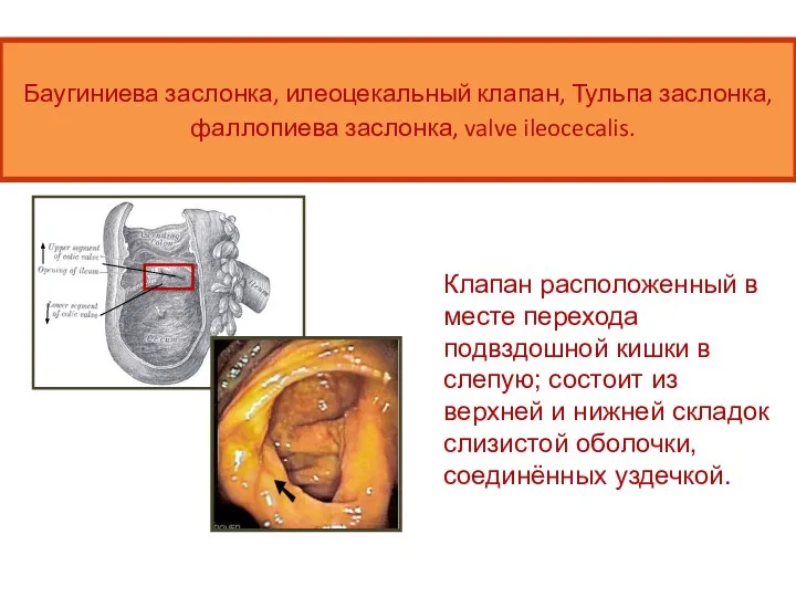 Баугиниева заслонка, илеоцекальный клапан, Тульпа заслонка, фаллопиева заслонка, valve ileocecalis. Клапан