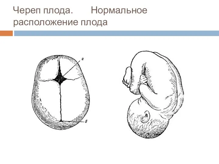 Череп плода. Нормальное расположение плода