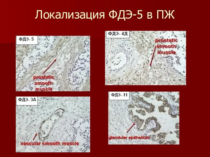 Локализация ФДЭ-5 в ПЖ