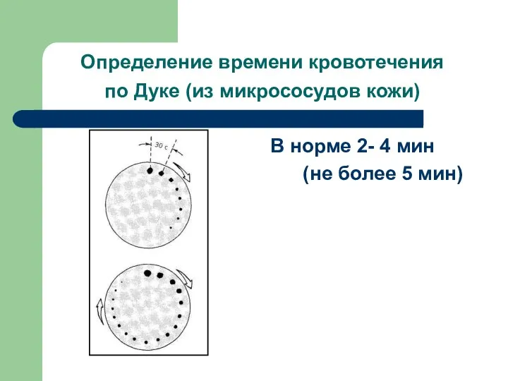 В норме 2- 4 мин (не более 5 мин) Определение времени