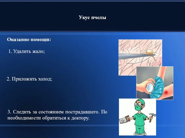 Укус пчелы 2. Приложить холод; 1. Удалить жало; 3. Следить за