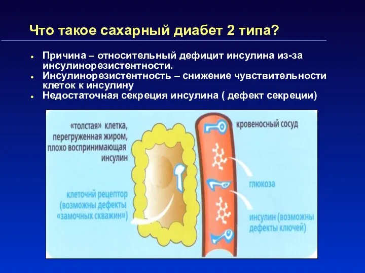 Что такое сахарный диабет 2 типа? Причина – относительный дефицит инсулина