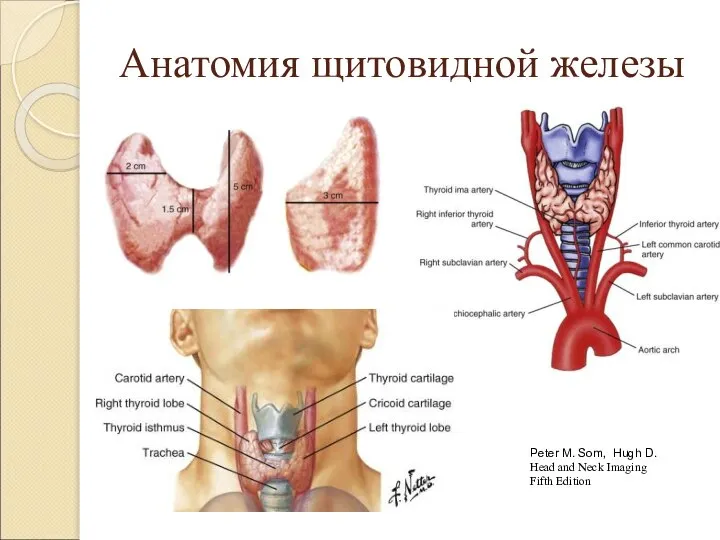 Анатомия щитовидной железы Peter M. Som, Hugh D. Head and Neck Imaging Fifth Edition