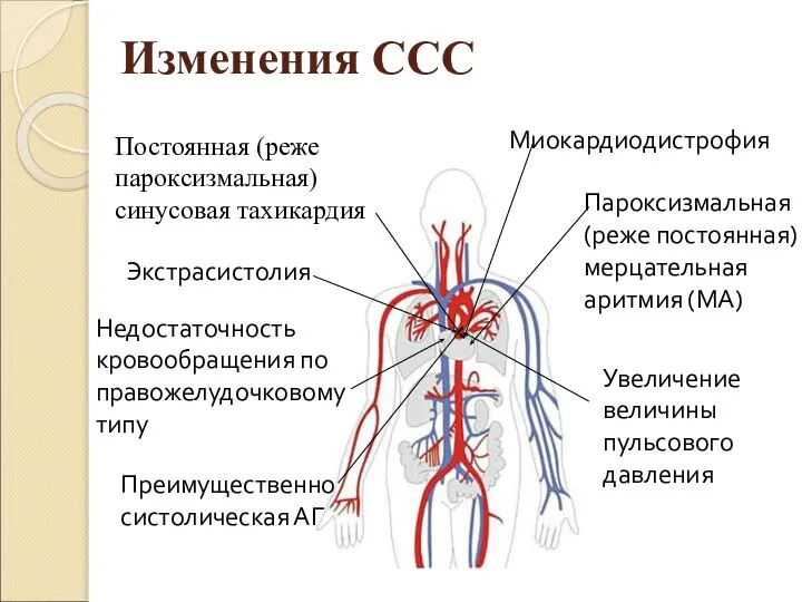 Изменения ССС Постоянная (реже пароксизмальная) синусовая тахикардия Экстрасистолия Пароксизмальная (реже постоянная)