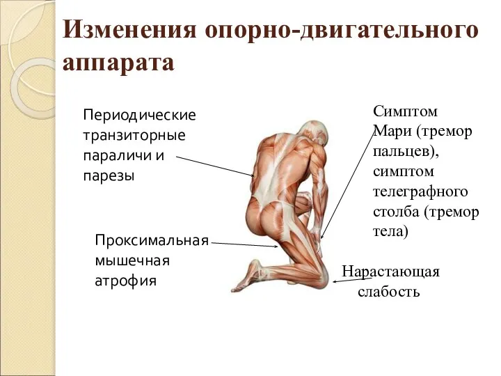 Изменения опорно-двигательного аппарата Нарастающая слабость Проксимальная мышечная атрофия Симптом Мари (тремор