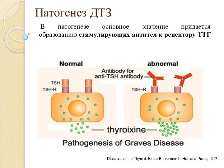 Патогенез ДТЗ Diseases of the Thyroid. Editor Braverman L. Humana Press,