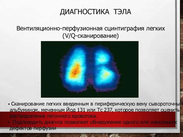 Вентиляционно-перфузионная сцинтиграфия легких (V/Q-сканирование) ДИАГНОСТИКА ТЭЛА Сканирование легких введенным в периферическую