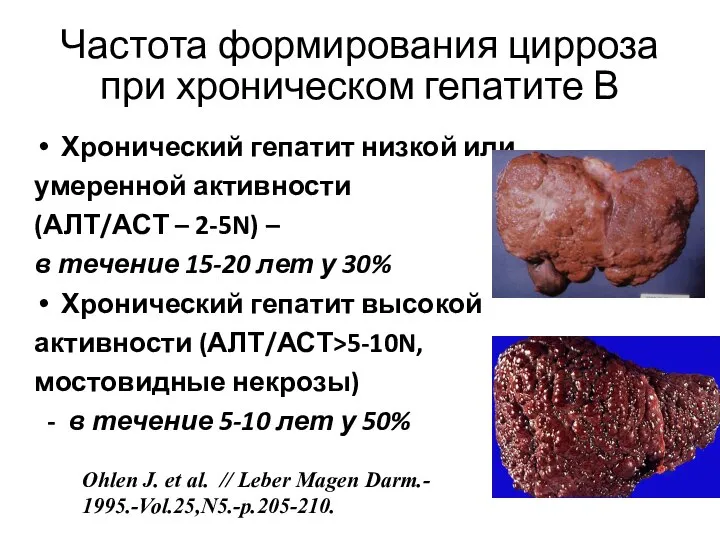 Частота формирования цирроза при хроническом гепатите В Хронический гепатит низкой или