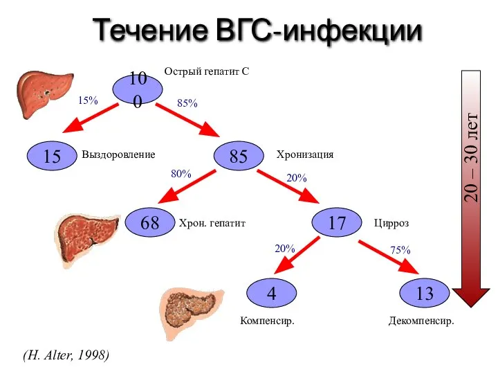 100 Течение ВГС-инфекции Острый гепатит С 85 15 Выздоровление Хронизация 15%