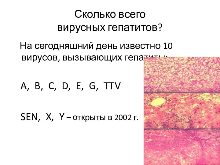 Сколько всего вирусных гепатитов? На сегодняшний день известно 10 вирусов, вызывающих