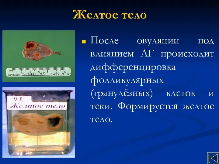 Желтое тело После овуляции под влиянием ЛГ происходит дифференцировка фолликулярных (гранулёзных)