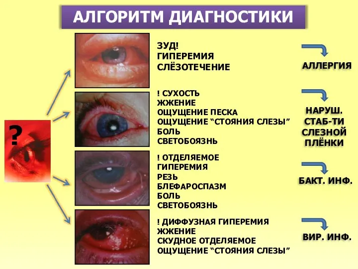 АЛГОРИТМ ДИАГНОСТИКИ ? ЗУД! ГИПЕРЕМИЯ СЛЁЗОТЕЧЕНИЕ ! СУХОСТЬ ЖЖЕНИЕ ОЩУЩЕНИЕ ПЕСКА