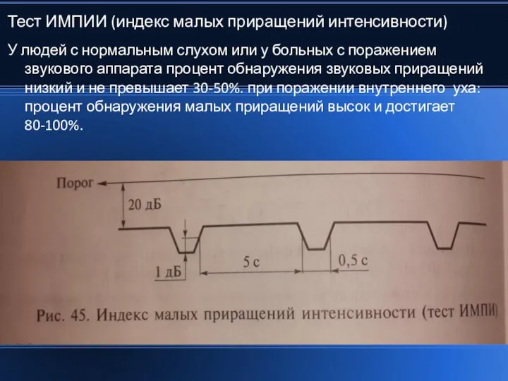 Тест ИМПИИ (индекс малых приращений интенсивности) У людей с нормальным слухом