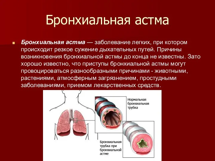 Бронхиальная астма Бронхиальная астма — заболевание легких, при котором происходит резкое