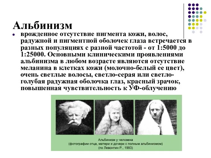 Альбинизм врожденное отсутствие пигмента кожи, волос, радужной и пигментной оболочек глаза