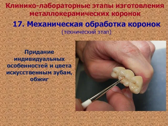 Придание индивидуальных особенностей и цвета искусственным зубам, обжиг Клинико-лабораторные этапы изготовления