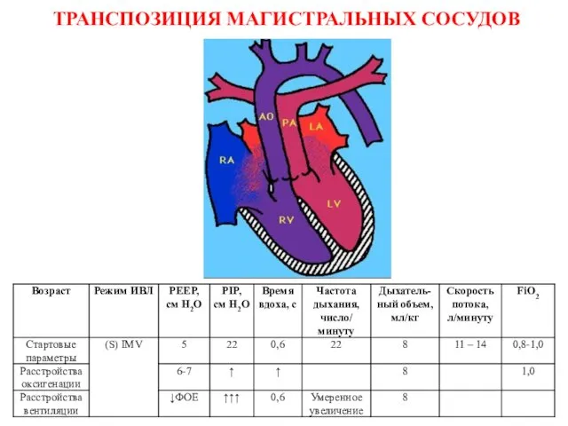 ТРАНСПОЗИЦИЯ МАГИСТРАЛЬНЫХ СОСУДОВ