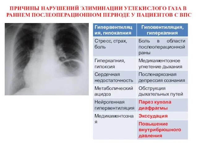 ПРИЧИНЫ НАРУШЕНИЙ ЭЛИМИНАЦИИ УГЛЕКИСЛОГО ГАЗА В РАННЕМ ПОСЛЕОПЕРАЦИОННОМ ПЕРИОДЕ У ПАЦИЕНТОВ С ВПС