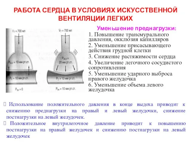 РАБОТА СЕРДЦА В УСЛОВИЯХ ИСКУССТВЕННОЙ ВЕНТИЛЯЦИИ ЛЕГКИХ Уменьшение преднагрузки: 1. Повышение