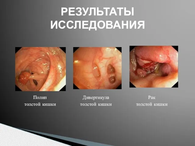 РЕЗУЛЬТАТЫ ИССЛЕДОВАНИЯ