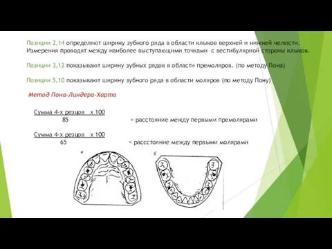 Позиции 2,14 определяют ширину зубного ряда в области клыков верхней и