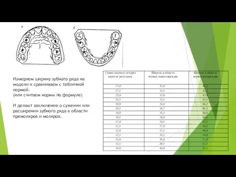 Измеряем ширину зубного ряда на модели и сравниваем с табличной нормой.