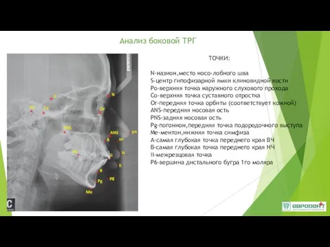 Анализ боковой ТРГ ТОЧКИ: N-назион,место носо-лобного шва S-центр гипофизарной ямки клиновидной