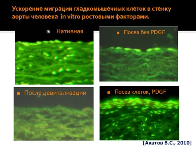 Ускорение миграции гладкомышечных клеток в стенку аорты человека in vitro ростовыми