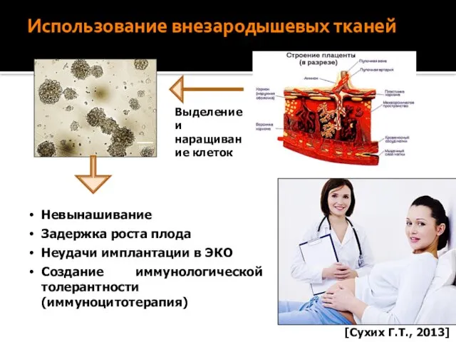 Использование внезародышевых тканей Невынашивание Задержка роста плода Неудачи имплантации в ЭКО