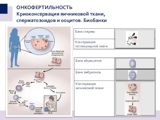 ОНКОФЕРТИЛЬНОСТЬ Криоконсервация яичниковой ткани, сперматозоидов и ооцитов. Биобанки