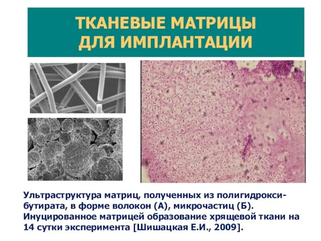 Ультраструктура матриц, полученных из полигидрокси-бутирата, в форме волокон (А), микрочастиц (Б).