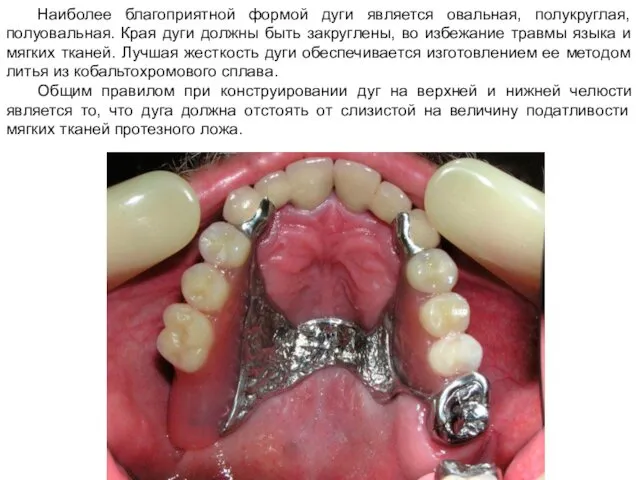 Наиболее благоприятной формой дуги является овальная, полукруглая, полуовальная. Края дуги должны