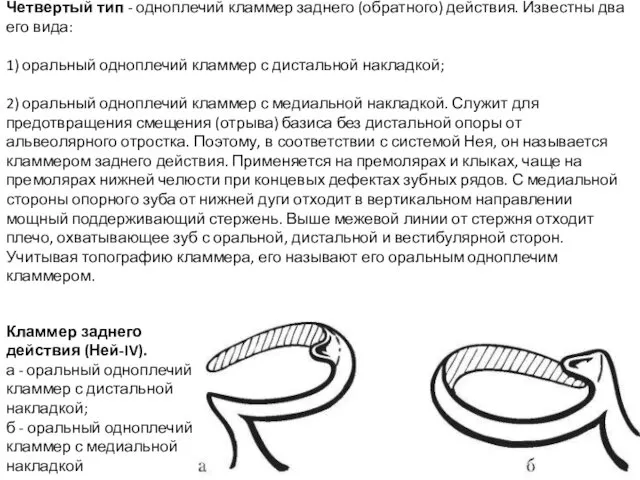 Четвертый тип - одноплечий кламмер заднего (обратного) действия. Известны два его