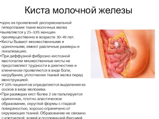 Киста молочной железы одно из проявлений дисгормональной гиперплазии ткани молочных желез