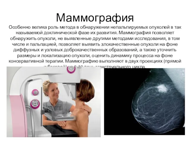 Маммография Особенно велика роль метода в обнаружении непальпируемых опухолей в так