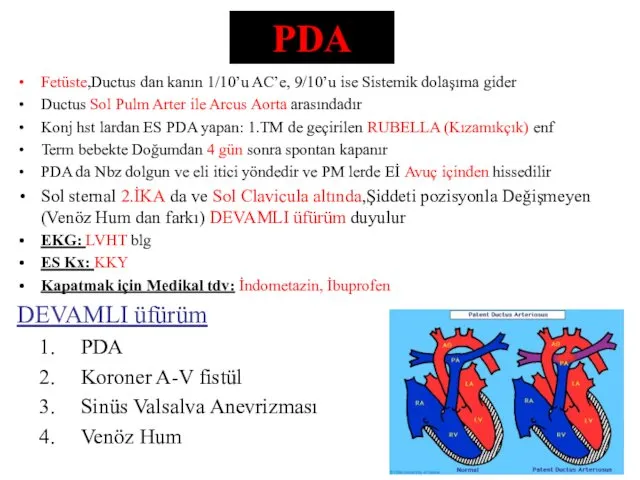 PDA Fetüste,Ductus dan kanın 1/10’u AC’e, 9/10’u ise Sistemik dolaşıma gider