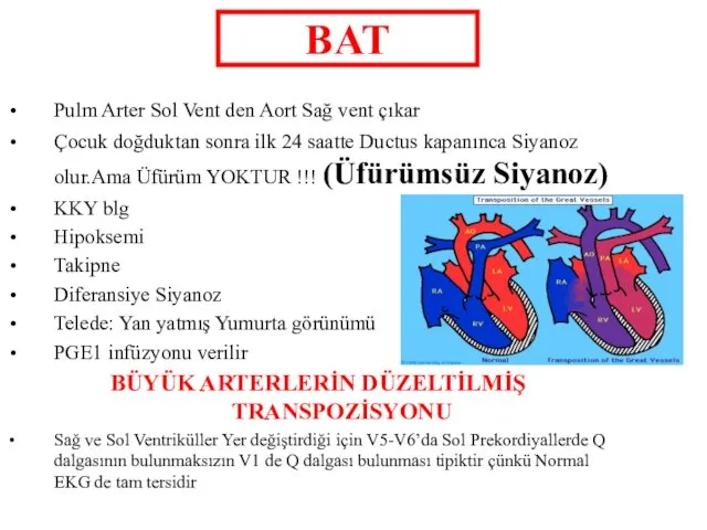 BAT Pulm Arter Sol Vent den Aort Sağ vent çıkar Çocuk