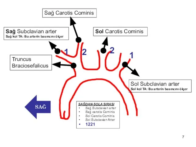 Truncus Braciosefalicus Sağ Subclavian arter Sağ kol TA: Bu arterin basıncını