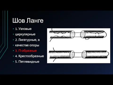 Шов Ланге 1. Узловые циркулярные 2. Лигатурные, в качестве опоры 3. П-образные 4. Крестообразные 5. Петлевидные