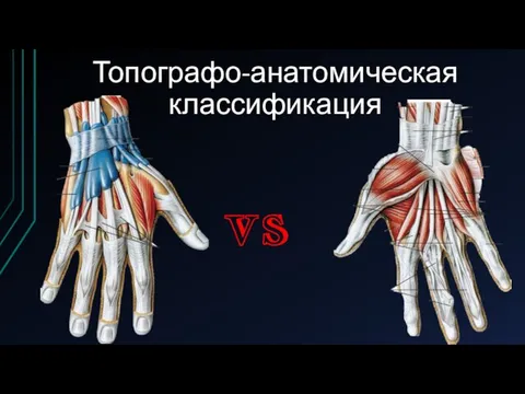 Топографо-анатомическая классификация vs