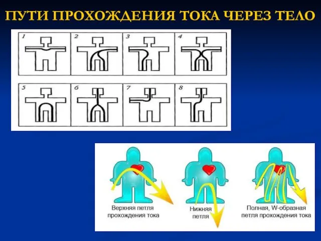 ПУТИ ПРОХОЖДЕНИЯ ТОКА ЧЕРЕЗ ТЕЛО