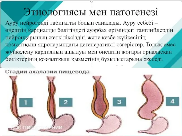 Этиологиясы мен патогенезі Ауру нейрогенді табиғатты болып саналады. Ауру себебі –