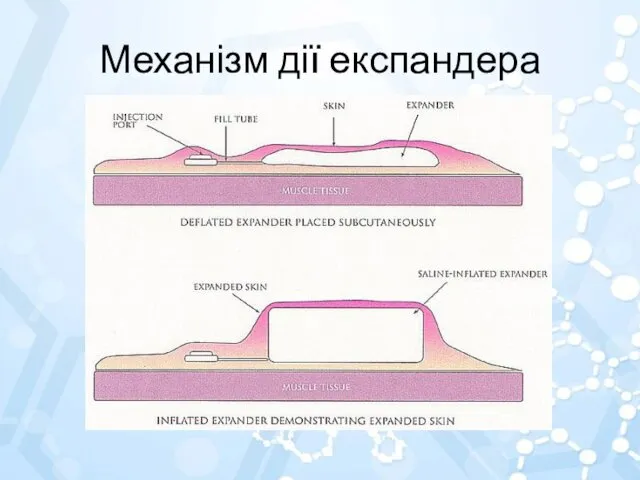 Механізм дії експандера