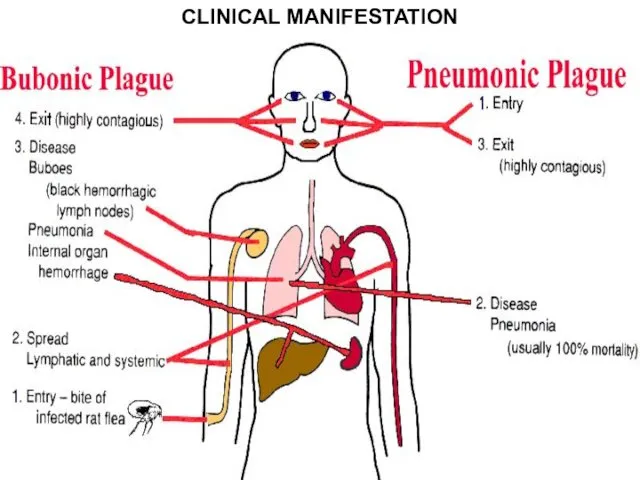 CLINICAL MANIFESTATION