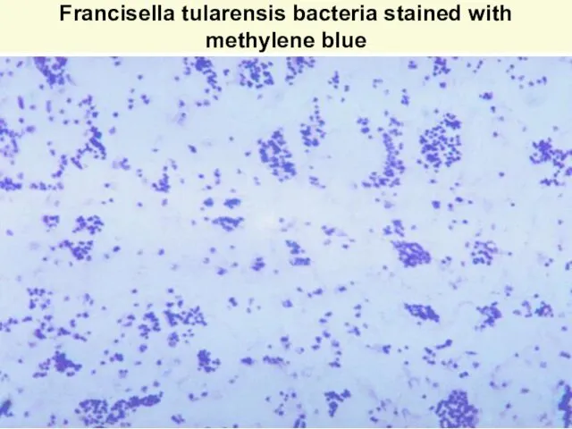 Francisella tularensis bacteria stained with methylene blue