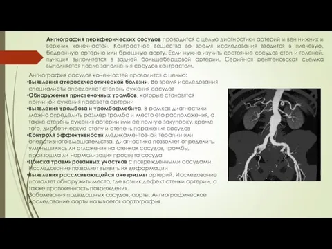 Ангиография периферических сосудов проводится с целью диагностики артерий и вен нижних