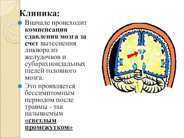 Клиника: Вначале происходит компенсация сдавления мозга за счет вытеснения ликвора из