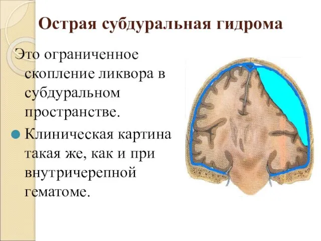 Острая субдуральная гидрома Это ограниченное скопление ликвора в субдуральном пространстве. Клиническая