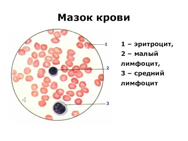 Мазок крови 1 – эритроцит, 2 – малый лимфоцит, 3 – средний лимфоцит